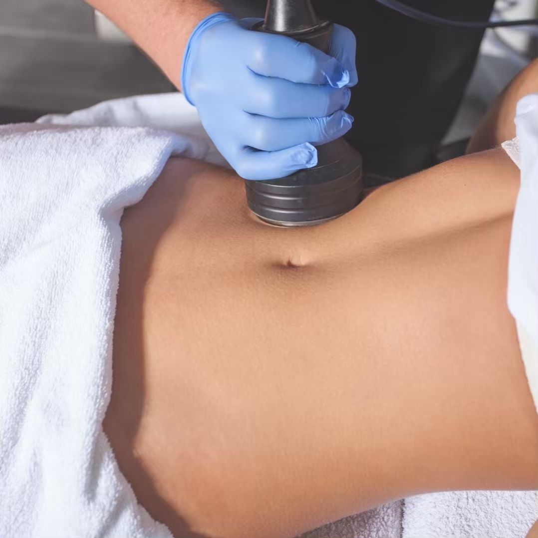 Body sculpt treatment for toning and shaping the body in Burnley