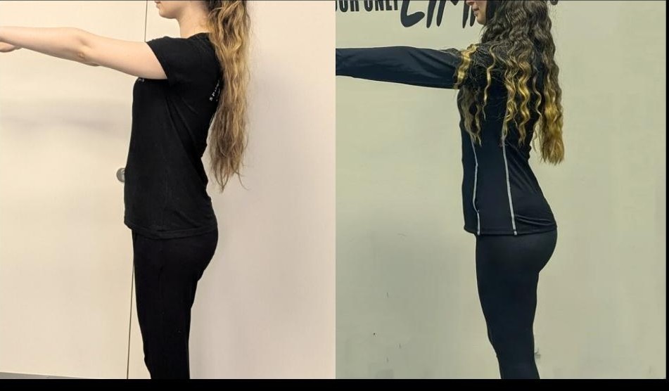 Before body transformation showing initial fitness condition